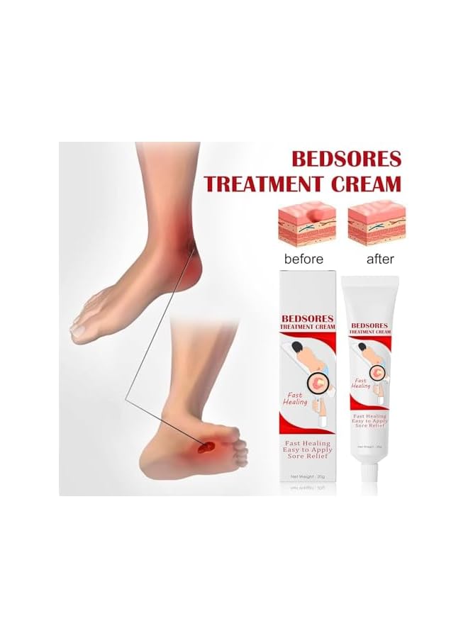 إيلهو كريم لعلاج ومنع قرح الضغط، مرهم عشبي لقرح الفراش، تخفيف للقرح من المرحلة 1 إلى 4، 20 جرام - Image 2