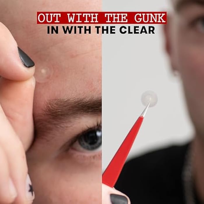 THAYERS Invisible S.O.S Hydrocolloid Acne Pimple Patch, Ultra-Thin Design Instantly Reduces Look of Blemishes, Set of 22 Pimple Patches - Image 3