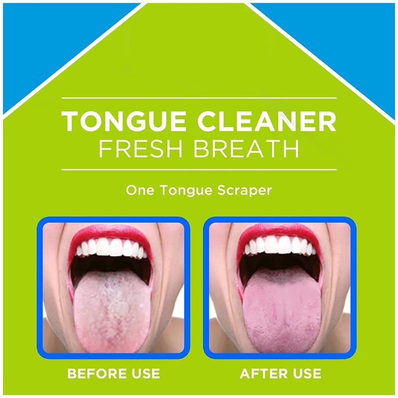 AmigozZ Tongue Cleaner, Scraper Helps Cure Bad Breath - Colors May Vary (2pcs) - Image 5