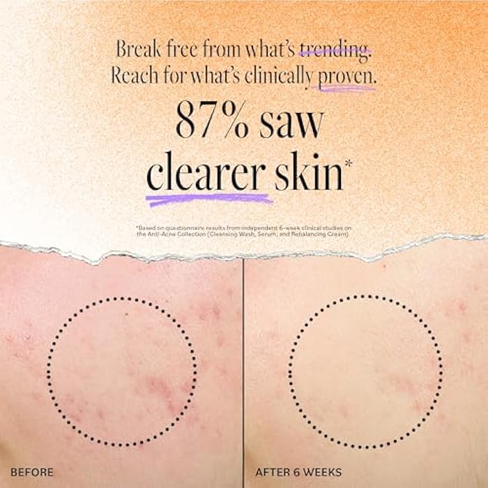 derma-e DERMA E Acne Spot Treatment, Acne Blemish Control Treatment Serum, 2 Fl Oz, Clinically Studied to Help Fight Blackheads, Breakouts and Cystic Acne for Clearer Looking Skin - Image 3