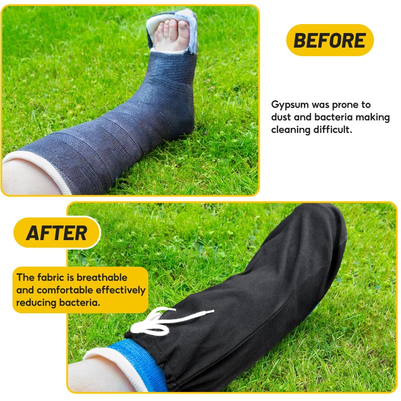 Max Shape Washable Knee Sock  Adjustable Leg Cast Cover for Men & Women  Medium Short Foot Cast Sock (Gray+Black) - Image 5