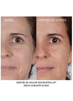 Beaume BEAUME® Set: Dermaroller with 540 needles • the Original • certified in Germany (0,50mm) & BEAUME® Highly Concentrated Hyaluron Serum 30ml • free of parabens  - Image 2