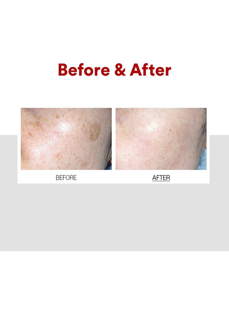 MEDIPEEL - Melanon Medi Peel Cream | Helps Reduce Dark Spots | Anti Aging | K-Beauty Skin Care | Treatment | Skin Lightening - Image 1