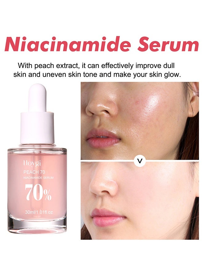 هويجي سيروم الخوخ 70 نياسيناميد 70٪ ، مصل تفتيح الوجه 30 مل - Image 3