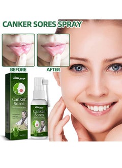 SOUTH MOON Canker Sore Treatment Spray ，Herbal Ulcer Treatment,Natural Mouth Sore Relief for Daily Oral Care, Mouth Spray,Treat Mouth Ulcer,Effective Mouth Sore Treatment-20ml  - Image 1