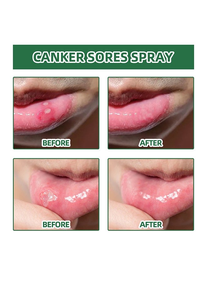 SOUTH MOON Canker Sore Treatment Spray ，Herbal Ulcer Treatment,Natural Mouth Sore Relief for Daily Oral Care, Mouth Spray,Treat Mouth Ulcer,Effective Mouth Sore Treatment-20ml  - Image 5
