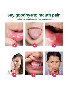 SOUTH MOON Canker Sore Treatment Spray ，Herbal Ulcer Treatment,Natural Mouth Sore Relief for Daily Oral Care, Mouth Spray,Treat Mouth Ulcer,Effective Mouth Sore Treatment-20ml  - Image 3