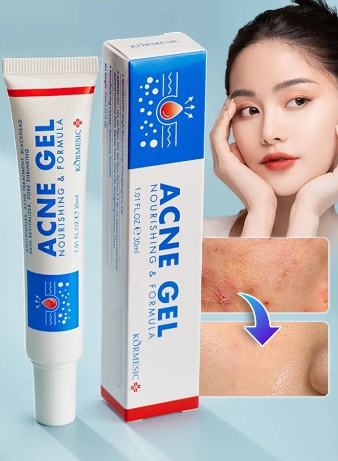 Kormesic جل حب الشباب 30 مل علاج بقع حب الشباب كريم حبوب للبشرة المعرضة لحب الشباب للعناية بجميع أنواع البشرة - Image 1