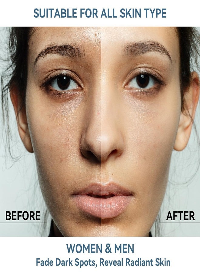 DMYGO Dark Spot Remover for Face and Body, Dark Spot Corrector Serum, Melasma, Age Spot & Freckles Remover, Skin Care Serum for Uneven Skin Tone with 360° Roller Massage Ball, 0.67 fl. oz - Image 3