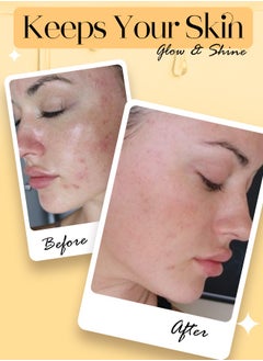 Muna Belleza Turmeric & Niacinamide Facial Mask Sheet - Anti-Acne, Brightening Skincare, Korean Formula, 25ml  - Image 4