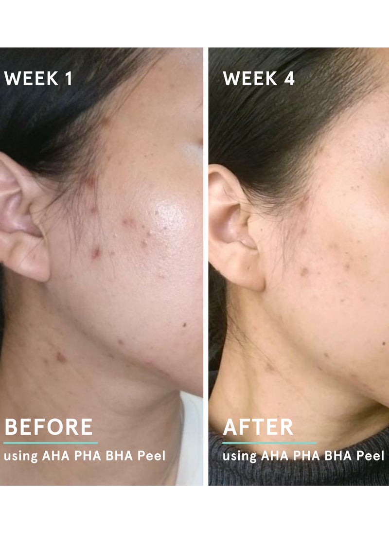 MINIMALIST - 10% AHA BHA Exfoliating Serum For Beginners | AHAs (Lactic Acid & Glycolic Acid) & BHA (Salicylic Acid) Serum - Image 1