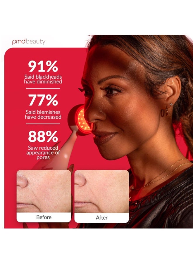 PMD Clean Redvolution Smart Facial Cleansing Device with Silicone Brush & Age-Defying Red Light Therapy Treatment - Image 4