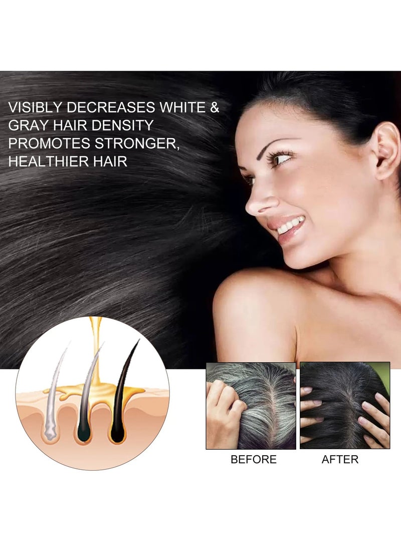 EELHOE Hair Fast Growth Serum, Hair Care Essential Oil For Damaged And Fizzy Hair, Hair Thinning Anti Hair Loss Hair Oil, Safe Dense Hair Essence For Scalp Cure Nourish Prevent Baldness, 30ml - Image 2