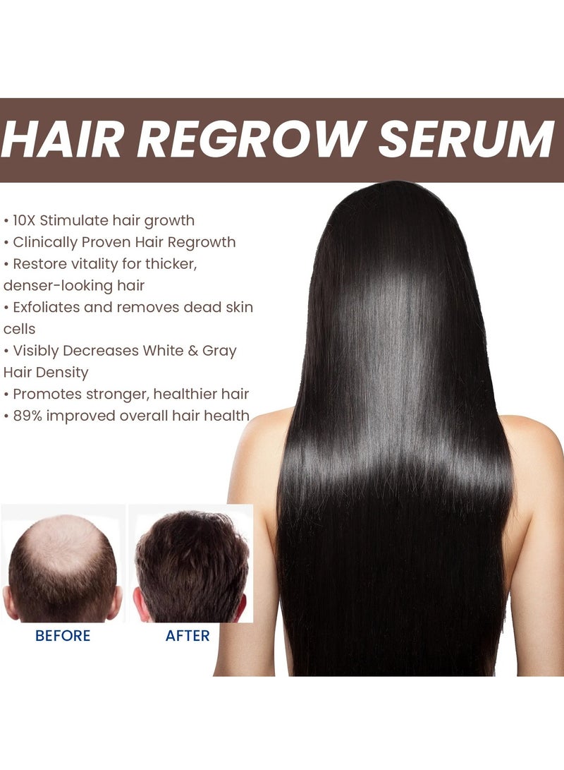 EELHOE Hair Fast Growth Serum, Hair Care Essential Oil For Damaged And Fizzy Hair, Hair Thinning Anti Hair Loss Hair Oil, Safe Dense Hair Essence For Scalp Cure Nourish Prevent Baldness, 30ml - Image 3