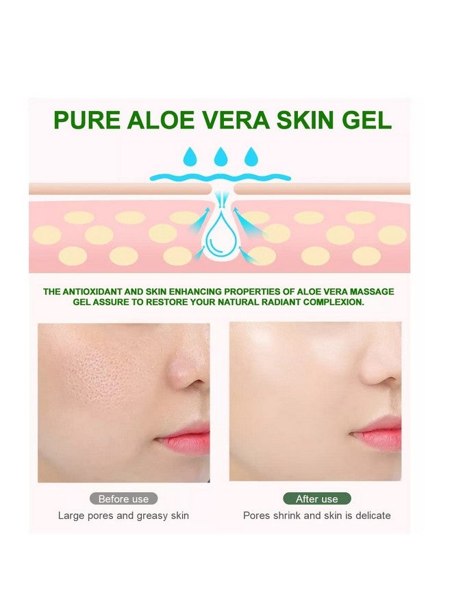NutriPro Pure Aloe Vera Skin Gel 240 ml | With Pure Aloe Vera & Vitamin E for Skin (Paraben Free) | For Acne, Scars, Glowing & Radiant Skin - Image 4