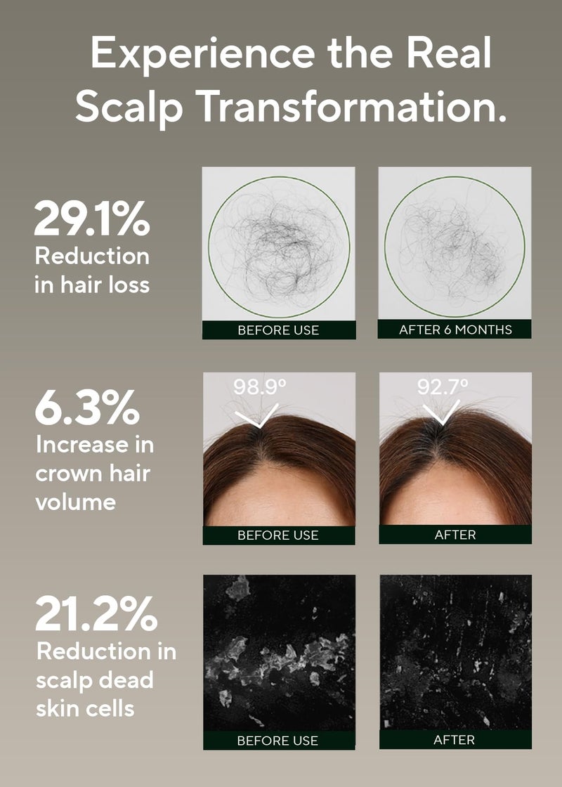 AROMATICA Rosemary Salt Scrub Shampoo - Hair Loss Korean Scalp Detox Shampoo with Rosemary Scalp Oil | Scalp Exfoliator with Salt Scrub for Oily Scalp | Sulfate Free, Silicone Free (10.5 oz / 300g) - Image 3