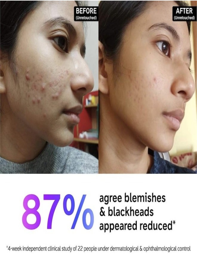 The Inkey List The INKEY List Salicylic Acid Acne + Blackhead Cleanser 150ml  - Image 4
