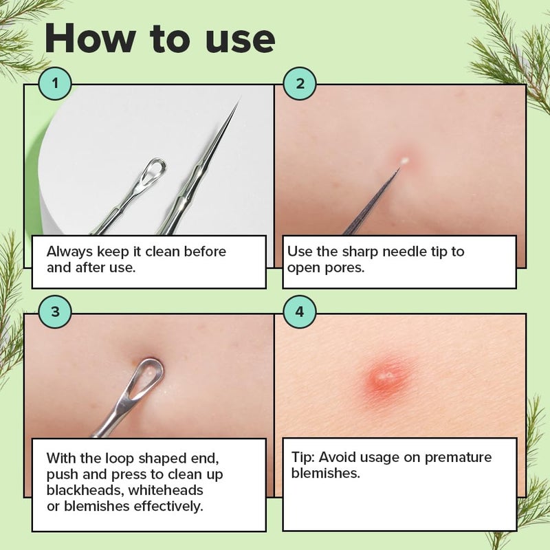 I DEW CARE أداة البثور ذات الطرفين من I DEW CARE - بوبير المناسب | مزيل الرؤوس السوداء، تقشير العيوب، معصرة حب الشباب الاحترافية، مستخرج الكوميدون للنساء، 2 في 1 من الفولاذ المقاوم للصدأ، 1 قطعة - Image 3