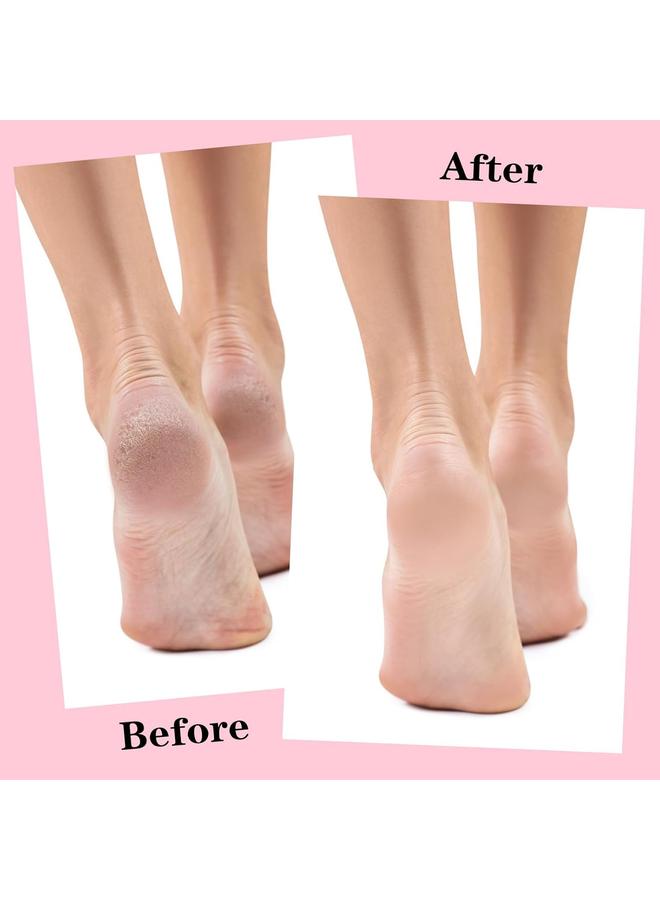 KOWVOWZ 3 أزواج من الجوارب السيليكونية، جوارب مرطبة، جوارب الألوفيرا للعناية بالقدمين للقدمين الجافة المتشققة، علاج سبا القدمين لإصلاح كعوب متشققة وتليين المسامير - Image 5