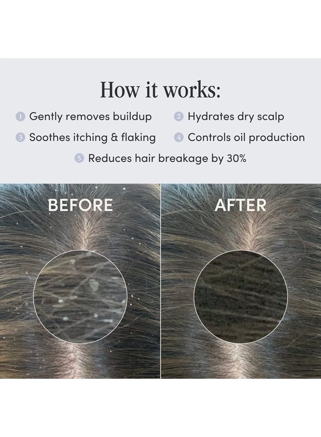 Jupiter Anti Dandruff Shampoo For Women & Men - Physician-Formulated For Flaky, Itchy, Oily, Dry Scalp Treatment - Vegan, Sulfate Free - Color Safe & Paraben Free Scalp Psoriasis Shampoo With Zinc - Image 3