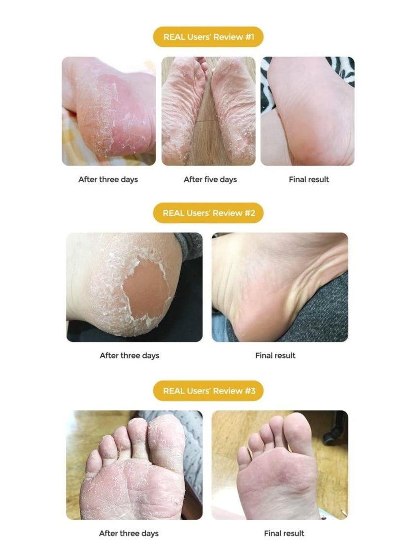 Purederm Exfoliating Foot Mask - 3 Pair  - Image 5