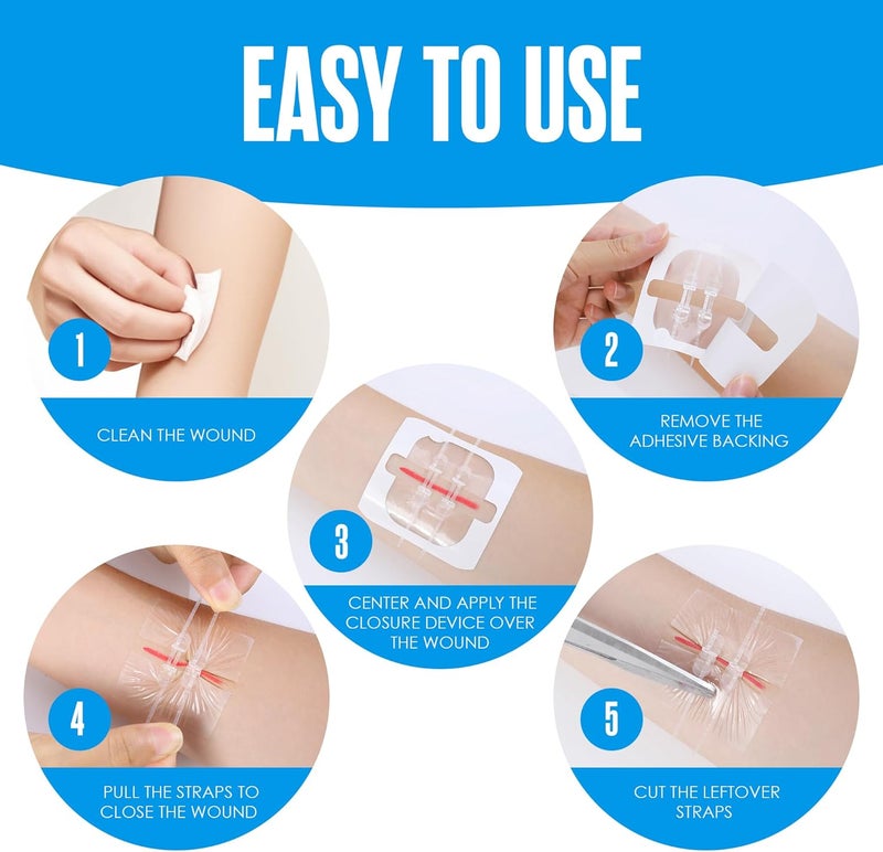 Houseables Butterfly Bandages Wound Closure Strips Laceration Closure Strips Butterfly Stitches For Wounds Zip Stitch Bandage Emergency Laceration Kit Zip Sutures Emergency Skin Zipper 4 Pack - Image 4