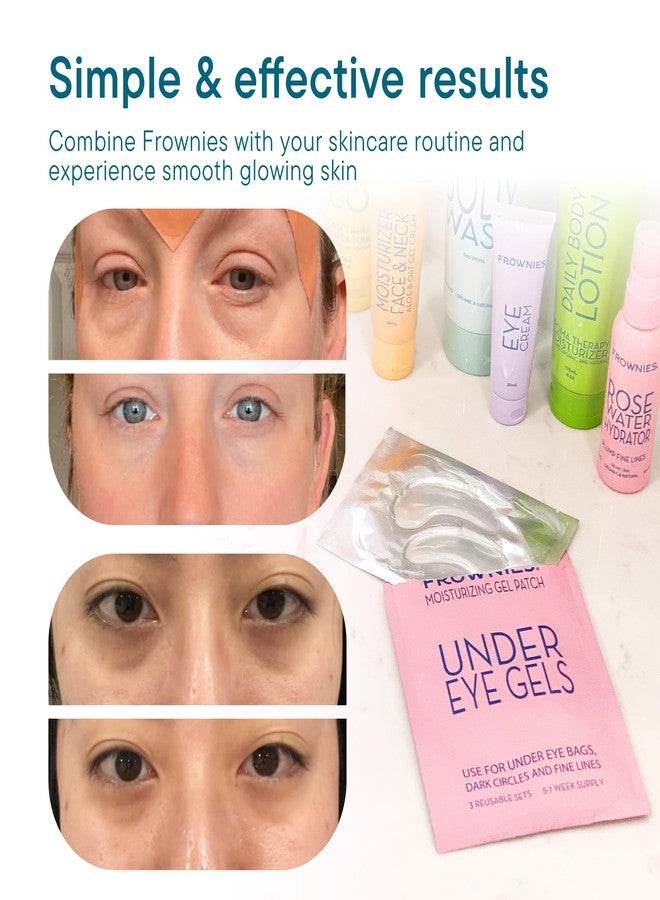 Frownies Under Eye Gel Patches for Puffy Eyes - Dark Circles with Cactus Collagen - Reusable, 6 Pack - Image 5