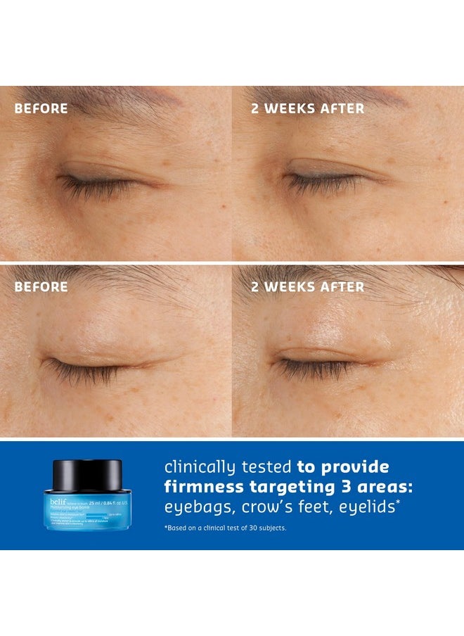 belif - The True Cream Moisturizing Eye Bomb Eye Cream Firms And Reduces Fine Lines Crow'S Feet And Wrinkles Peptide Ceramide Squalane Kbeauty - Image 1