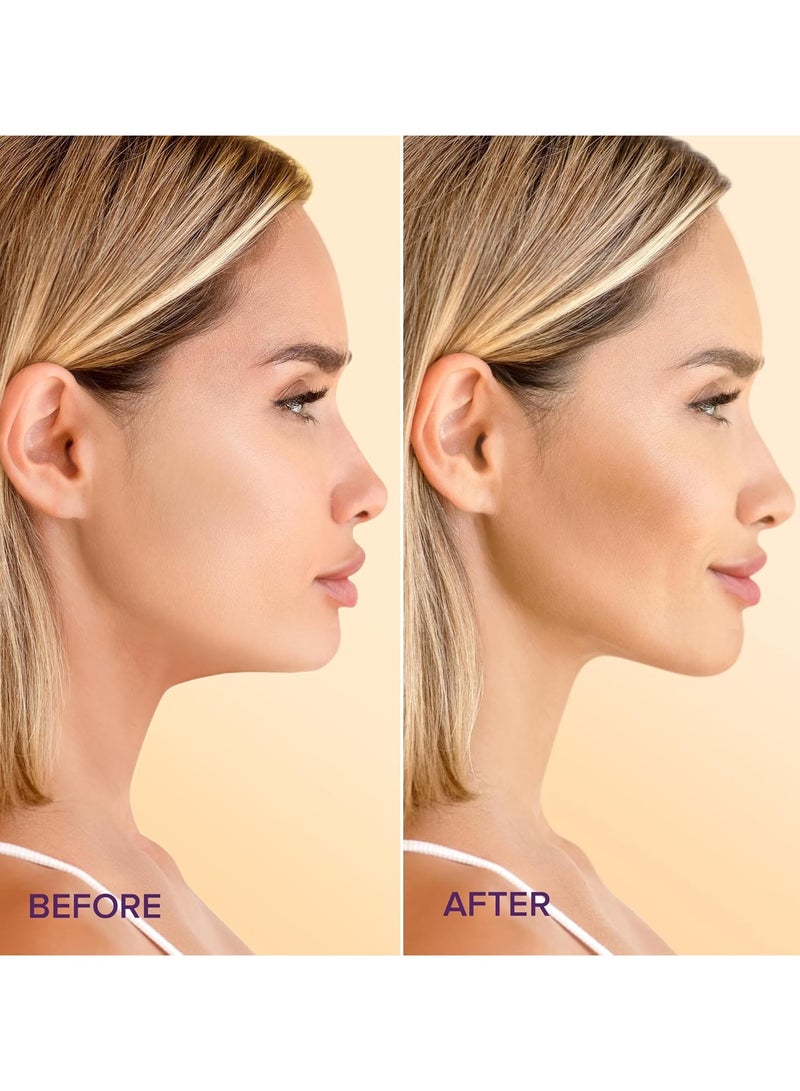 هويجي V Line Lifting Mask with 24K Gold - Deep Collagen Jawline Shaper with Retinol for Face Lift - حزام ذقن العناية بالبشرة للوجه - حمض الهيالورونيك، فيتامين إي - Image 2