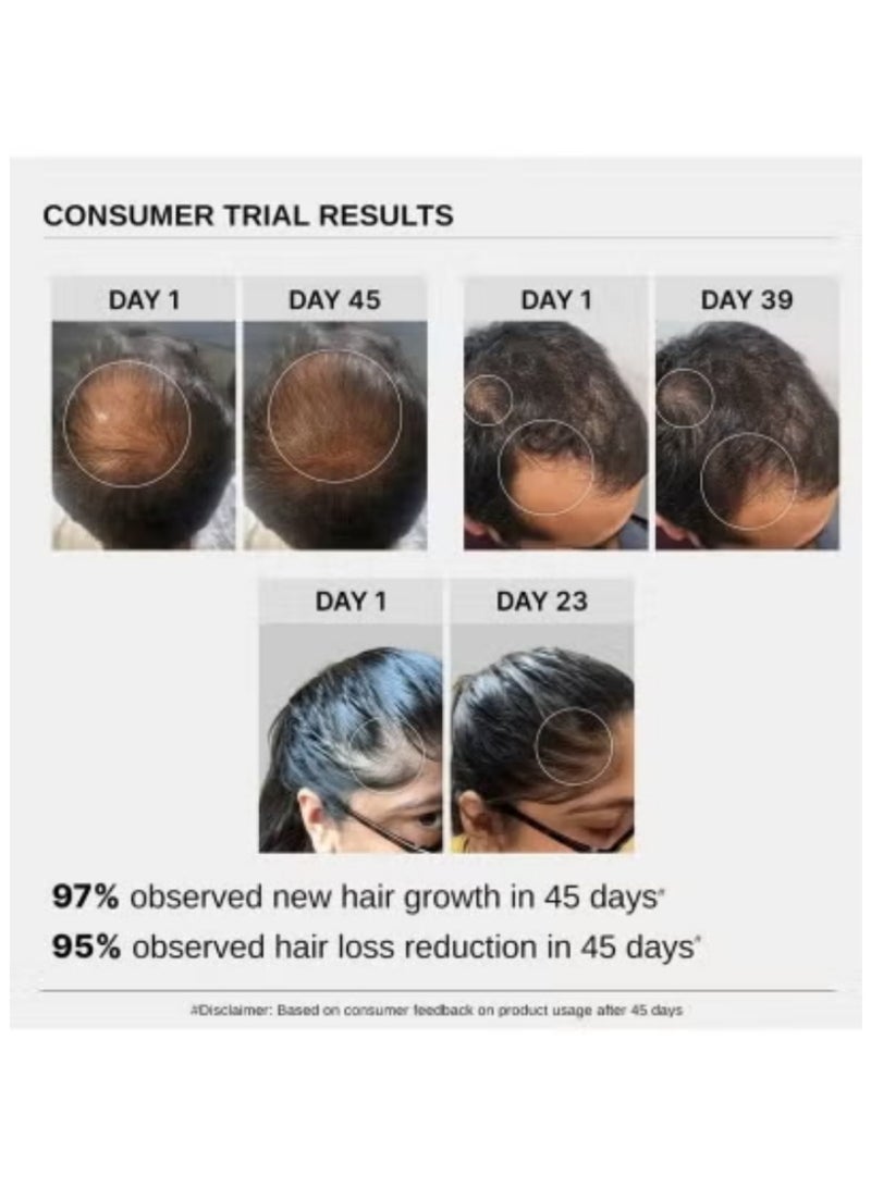 بار_اناتومي سيروم نمو الشعر المتقدم من بار أناتومي - حزمة مزدوجة 2 × 30 مل مع ريدنسيل، أناغين، بايكابيل وكابيليا لونغا لعلاج تساقط الشعر مع البيوتين ومستخلص الأرز من إكليل الجبل للرجال والنساء - Image 3