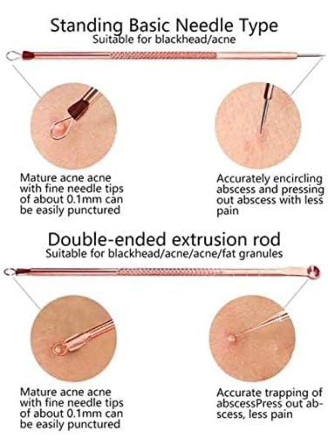 Remover Blackhead Remover Pimple Tool Kit, Set of 4 Stainless Steel Blackhead Removal Tool Pimple Popping Kit, Pimple Extractor Acne Tool - Image 4