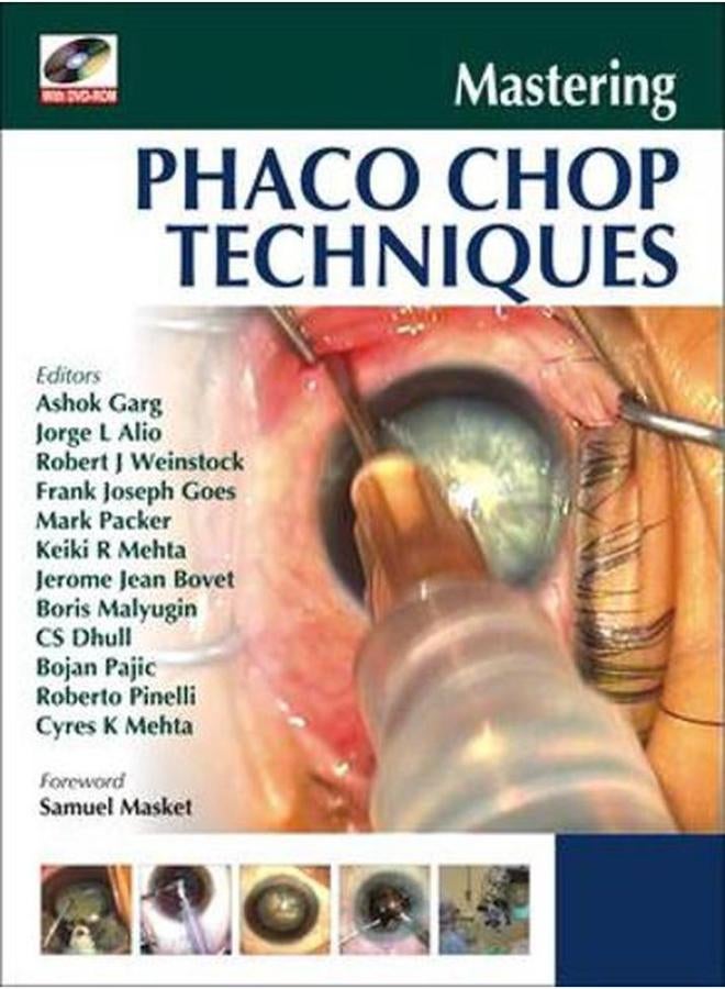 Mastering Phaco Chop Techniques 