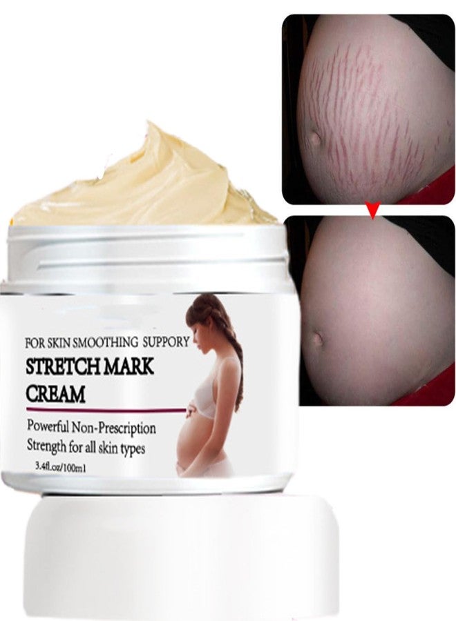 Rosarden Stretch Mark Prevention Cream for Pregnancy, Stretch Mark Cream Remover, Stretch Mark Lotion for Pregnancy, Tummy Butter for Stretch Marks Pregnancy, Shea Butter Stretch Mark Removal Cream - Image 1
