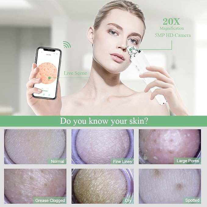 prabensei Blackhead Remover Pore Vacuum Upgraded WiFi Visible Facial Pore Cleanser with HD Camera Pimple Acne Comedone Extractor Kit with 6 Suction Heads USB Rechargeable Electric Black Head Suction Tool - Image 2
