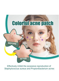 EELHOE Star-Shaped Acne Patch Repair Acne Fade Spots Acne Prints Cover Acne Repair Patch  - Image 2