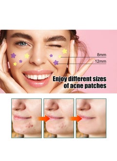 EELHOE Star-Shaped Acne Patch Repair Acne Fade Spots Acne Prints Cover Acne Repair Patch  - Image 4