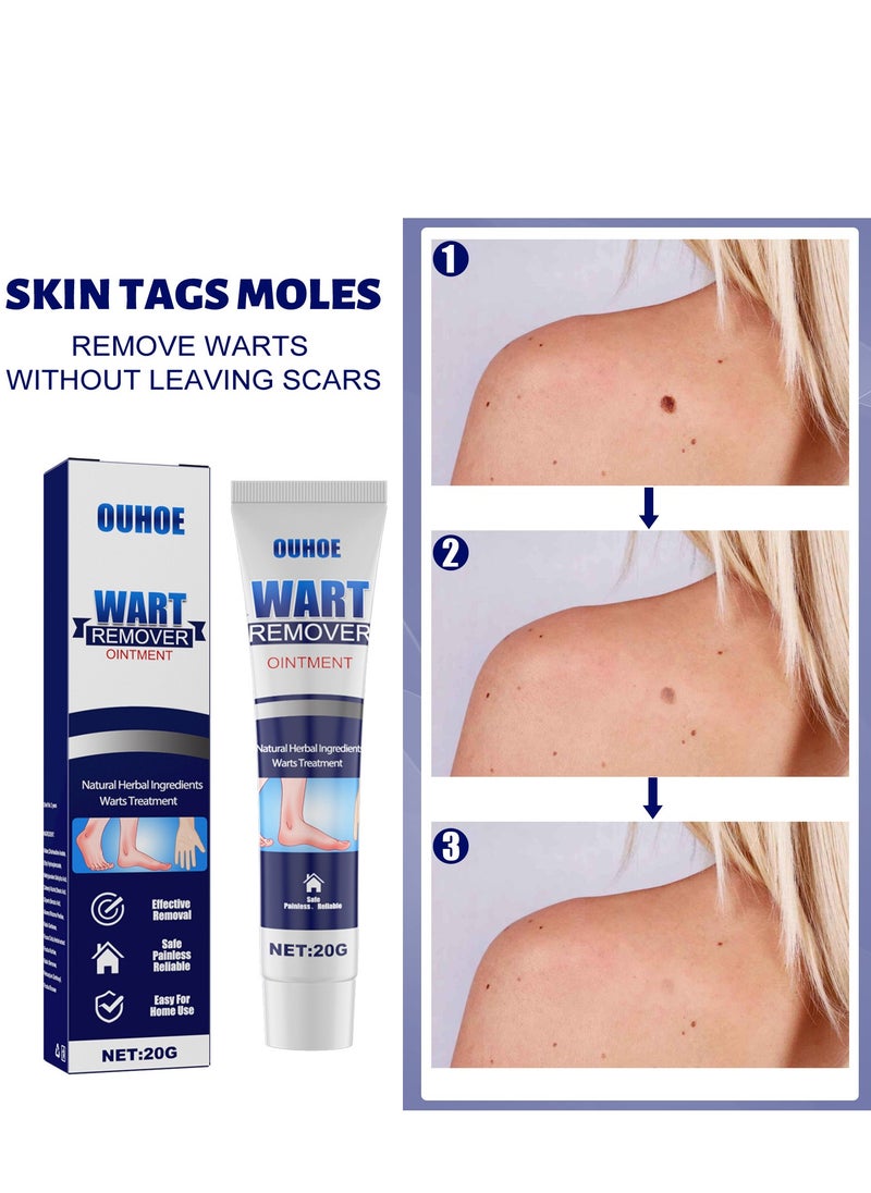 Wart Removal Ointment Natural Botanical Wart Removal Treatment Skin Repair Cream