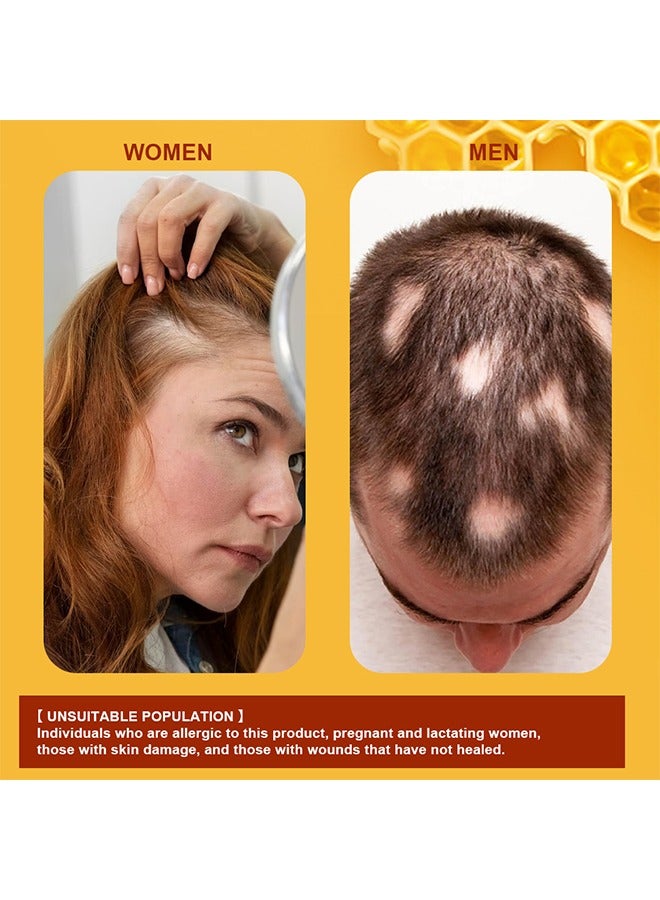 Sumifun Bee Venom Alopecia Hair Growth Cream - Revitalizing Scalp and Promoting Hair Growth - Effective Treatment for Alopecia & Thinning Hair - Nourishes & Strengthens Hair Follicles - Reduces Hair Loss 20g - Image 5