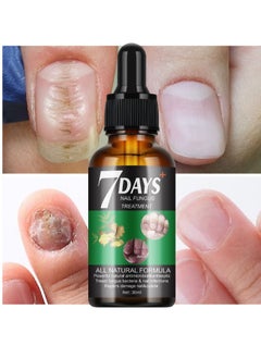 MOOYAM 7 DAYS Nail Fungus Treatment,Ginger Nail Treatment Nail Support Nail Care, , Ginger Nail Growth Serum, Ginger Cuticle Care Oil for Nails 30ml  - Image 1