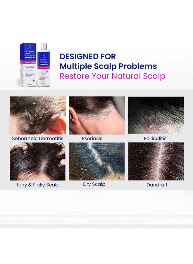 Thrudove - Psoriasis Shampoo For Scalp Treatment Seborrheic Dermatitis Shampoo Antifungal Shampoo Dry Scalp Shampoo Itchy Scalp Shampoo Dandruff Shampoo Folliculitis Shampoo Scalp Psoriasis Treatment - Image 1