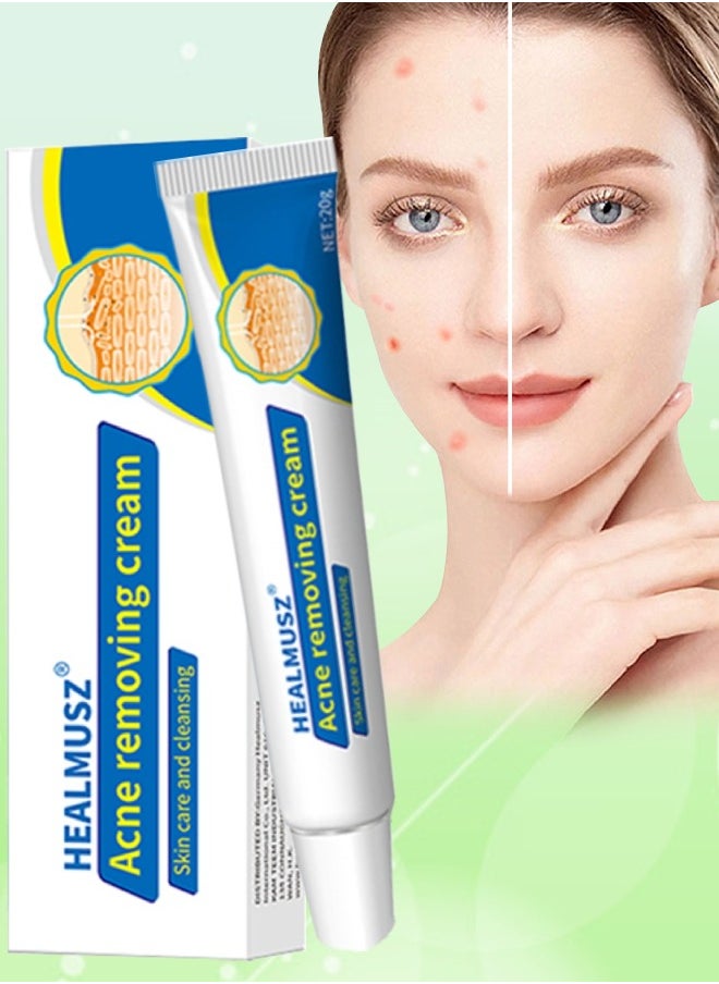 HEALMUSZ - Acne Removing Cream Natural Moisturizing Cream Acne Treatment Cream Skin Care and Cleansing Clear Face and Body Acne Blemish Cream for Acne and Blackheads Pimple Treatment Cream 20g - Image 1