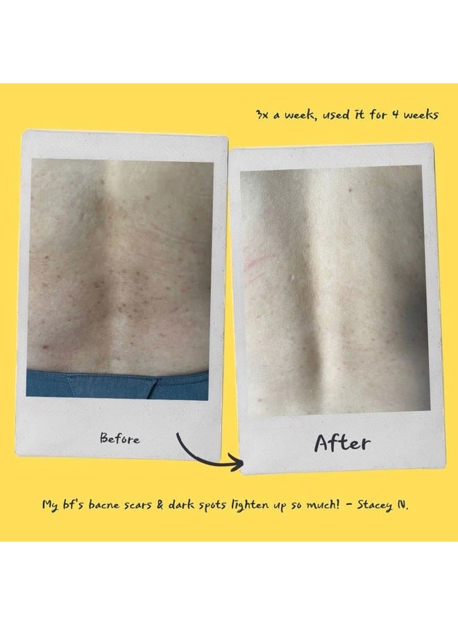 fytt Boost Energy Brightening Exfoliating Mask and Body Scrub | 100% Plant-Based, Vegan & Gluten-Free | Dark Spot Remover | Acne Scars | Skin care routine - Image 5