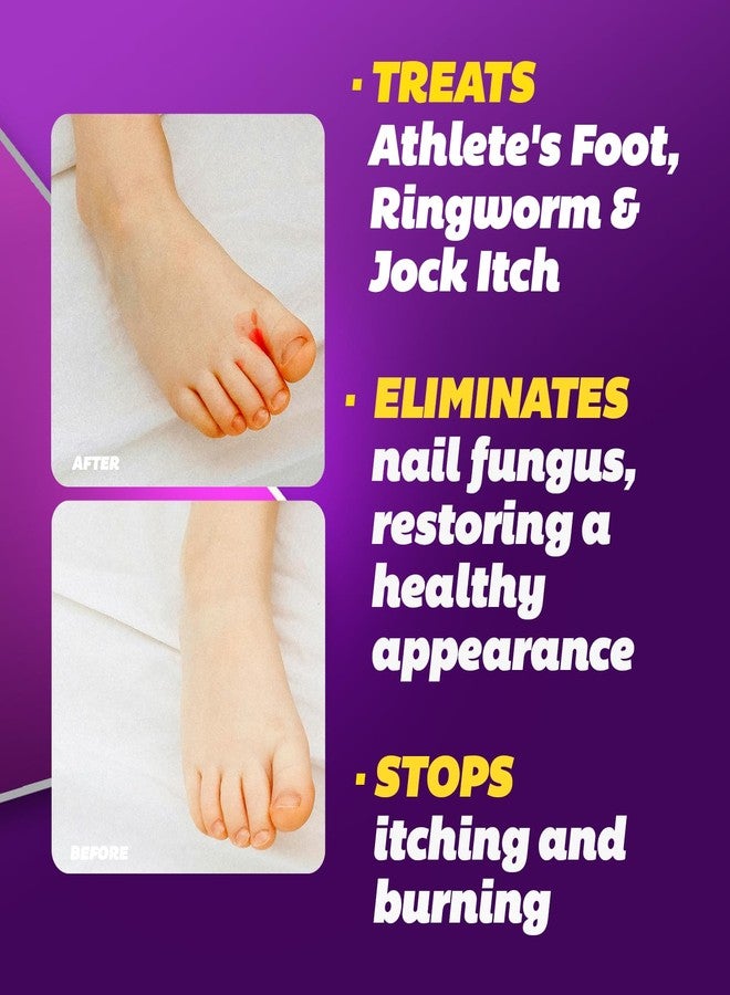 Silka Max Strength Antifungal Liquid & Cream Set - Powerful Relief for Toenail Fungus, Athlete's Foot, and Ringworm, Itch and Burn Relief - Image 3