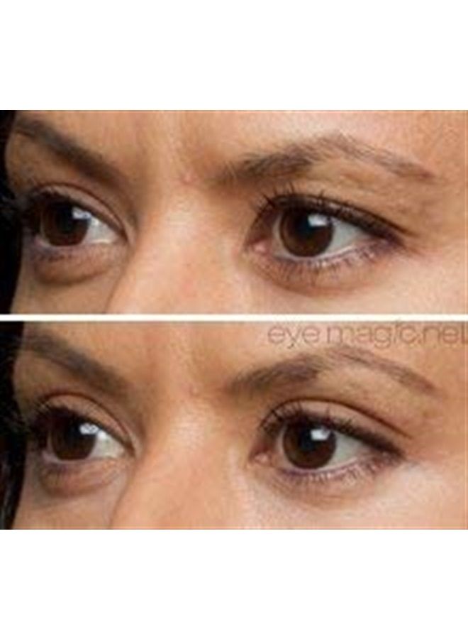 Eye Magic Original Eye Lift Kit (Small/Medium Size With Gel) Lifts Eyelid Droop and Hooded Eyes | Open And Show Off Your Beautiful Eyes | Made In America - Image 3