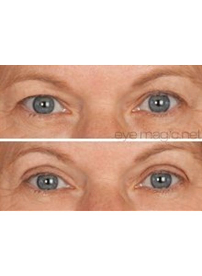 Eye Magic Original Eye Lift Kit (Small/Medium Size With Gel) Lifts Eyelid Droop and Hooded Eyes | Open And Show Off Your Beautiful Eyes | Made In America - Image 4