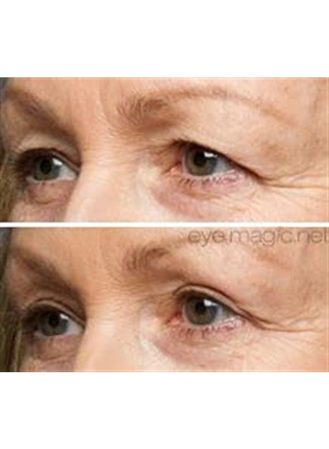 Eye Magic Original Eye Lift Kit (Small/Medium Size With Gel) Lifts Eyelid Droop and Hooded Eyes | Open And Show Off Your Beautiful Eyes | Made In America - Image 5