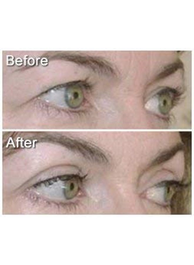 Eye Magic Original Eye Lift Kit (Small/Medium Size With Gel) Lifts Eyelid Droop and Hooded Eyes | Open And Show Off Your Beautiful Eyes | Made In America - Image 2