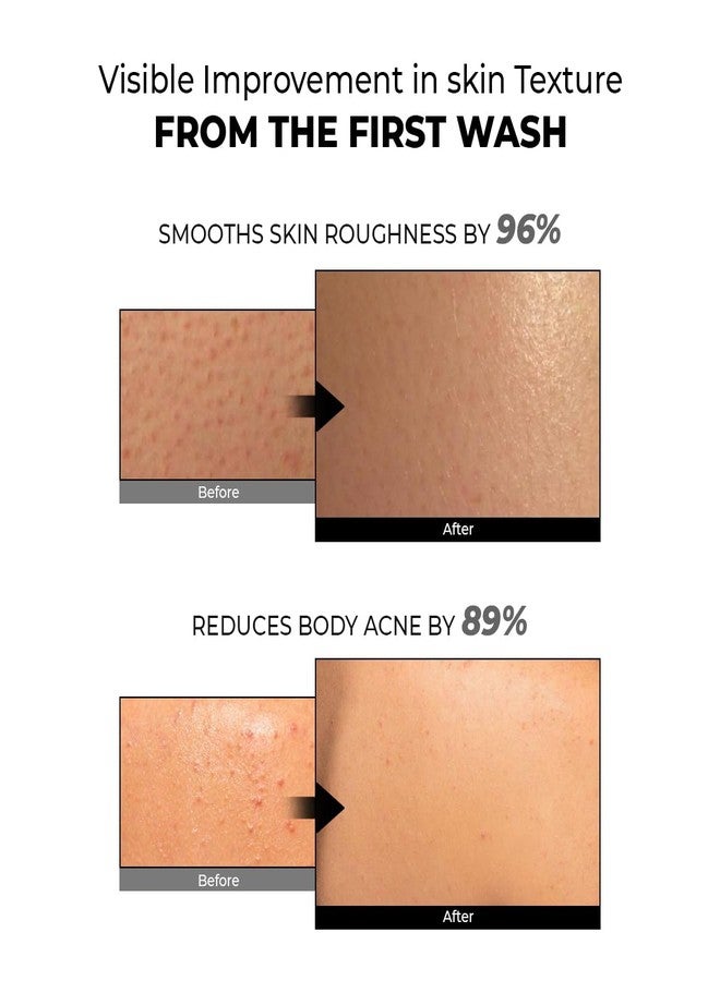 كيميائي واعي غسول الجسم المقشر من كونشيس كيميست® لإعادة ترطيب البشرة | 300 مل | جل استحمام يحتوي على 1% حمض الساليسيليك مع رمال بركانية وحمض اللاكتيك | يقشر البشرة، ويزيل حب الشباب، وينعم البشرة الخشنة | لعلاج التقرن الشعري وطفح جلدي على الساقين | مناسب للرجال والنساء، ولجميع أنواع البشرة - Image 4