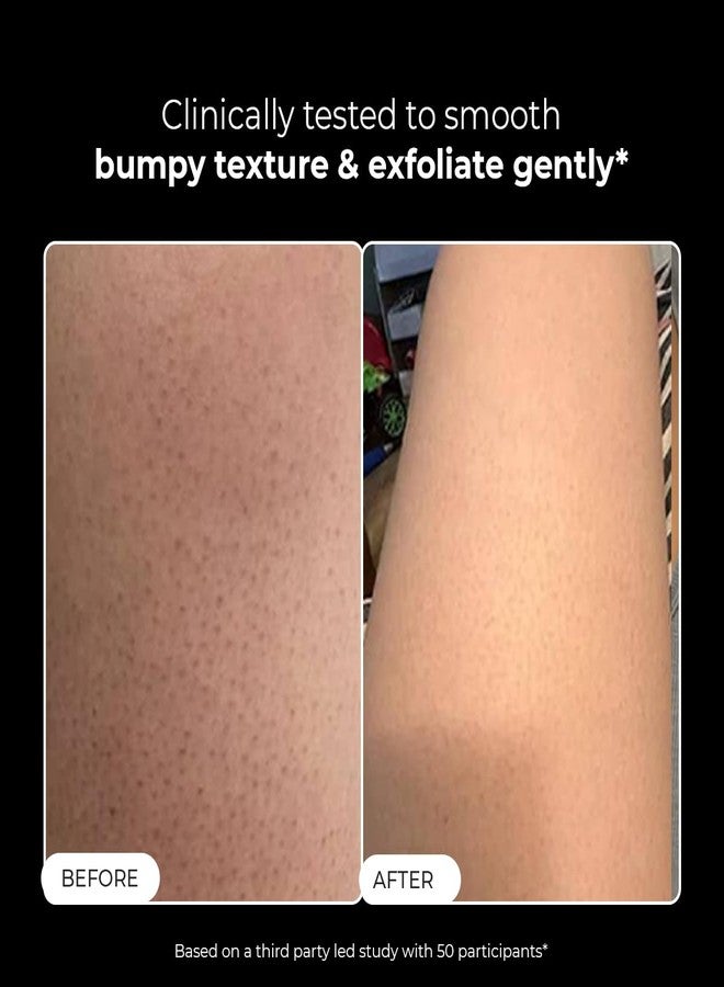 كيميائي واعي غسول الجسم المقشر من كونشيس كيميست® لإعادة ترطيب البشرة | 300 مل | جل استحمام يحتوي على 1% حمض الساليسيليك مع رمال بركانية وحمض اللاكتيك | يقشر البشرة، ويزيل حب الشباب، وينعم البشرة الخشنة | لعلاج التقرن الشعري وطفح جلدي على الساقين | مناسب للرجال والنساء، ولجميع أنواع البشرة - Image 2