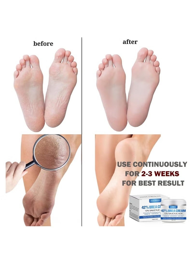 ISSUWEN Urea 42% Foot Cream, Cracked Heel Repair Cream For Feet and Hand, Callus Remover For Dry And Hard Skin, Maximum Strength With 2% Salicylic Acid for Hand, Foot and Body Care, 100g - Image 4